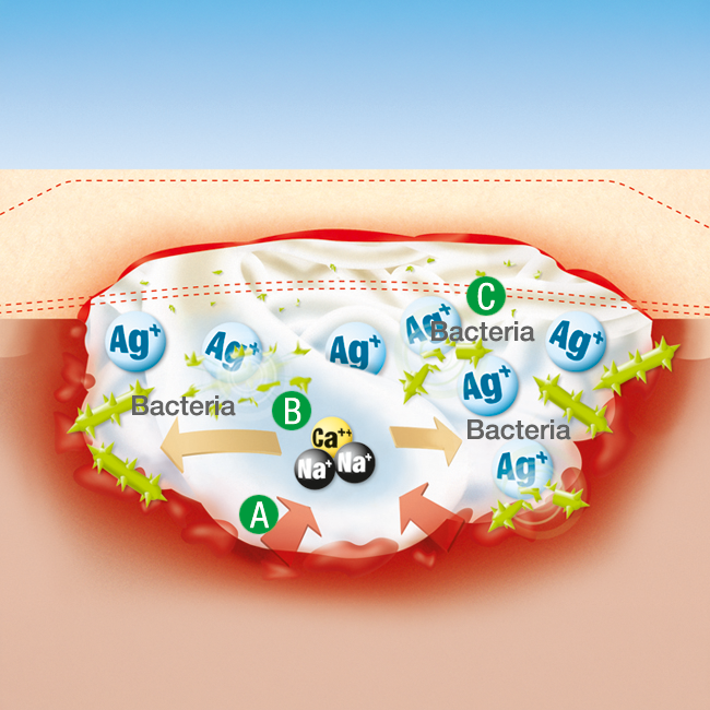 Suprasorb A